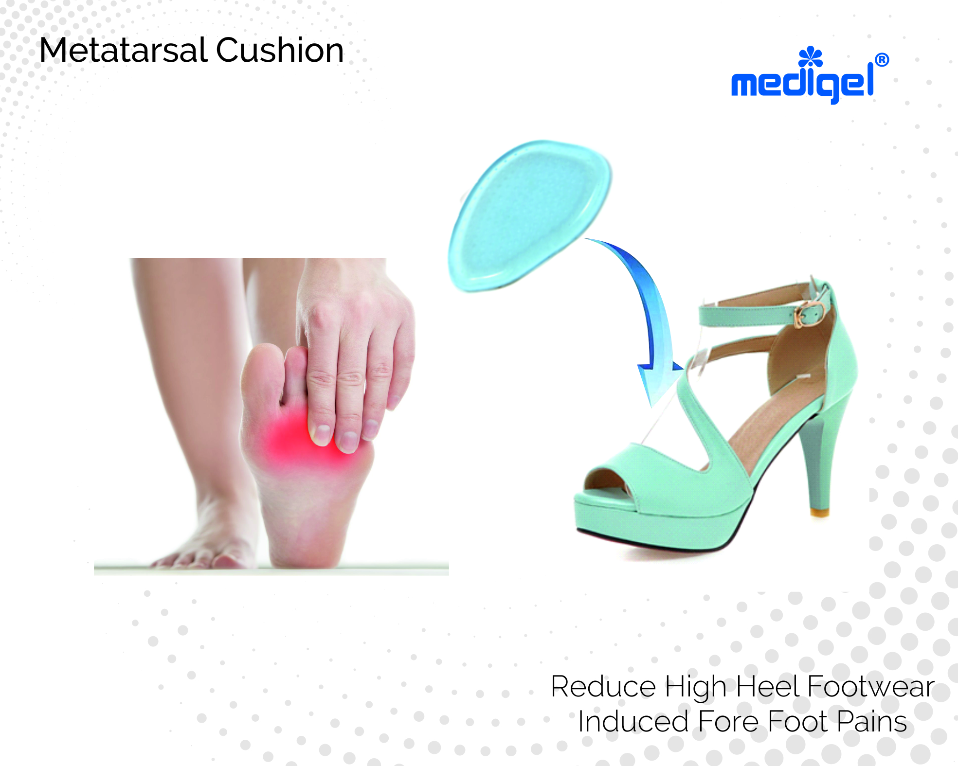 Medigel® Metatarsal Cushion/Pad (Small, Medium, Large)